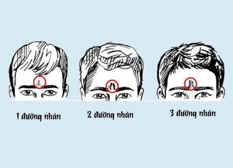 Đường nhăn trán tiết lộ gì về bạn? - Ảnh 1. Đường nhăn trán tiết lộ gì về bạn? - Ảnh 1.