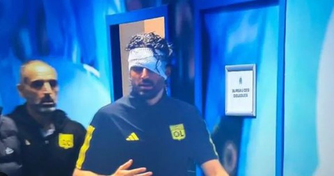 Điểm tin thể thao sáng 30-10: hoãn trận Marseille - Lyon vì cổ động viên tấn công xe buýt đối thủ - Ảnh 1. HLV Grosso bị thương do mảnh kính vỡ văng vào mặt - Ảnh: chụp từ video