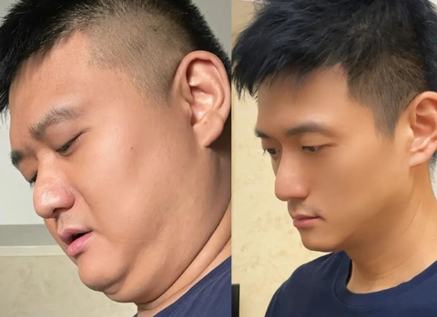 Ông chú 36 tuổi 'trẻ hóa' ngoạn mục sau khi giảm 50kg - Ảnh 2. Giảm cân là phương pháp "phẫu thuật thẩm mỹ" hiệu quả nhất.