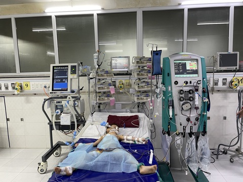 Bệnh tay chân miệng vẫn chưa hạ nhiệt, nhiều trường hợp nặng - Ảnh 1. Bệnh nhi mắc tay chân miệng nặng điều trị tại Bệnh viện Nhi đồng Cần Thơ - Ảnh: T.L.