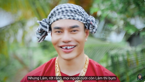 Lê Dương Bảo Lâm tung MV mới, âm mưu' tạo 'trend' mới hậu 'Sao hay ra dẻ quá' - Ảnh 3. Không quên "nhắc" hình ảnh rớt răng trứ danh của chính mình