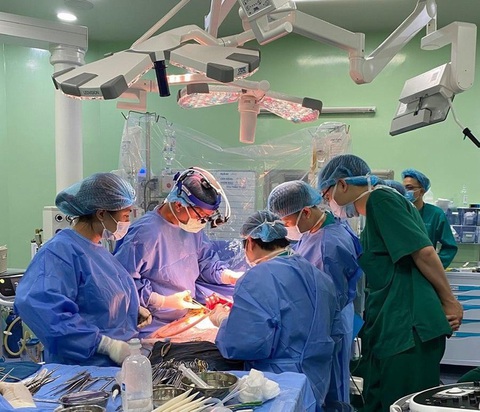 Ca phẫu thuật ghép gan cho bệnh nhi 18 tháng tuổi do các bác sĩ Bệnh viện Nhi trung ương và Bệnh viện trung ương Quân đội 108 thực hiện - Ảnh: BỆNH VIỆN CUNG CẤP Một ca phẫu thuật ghép gan do các bác sĩ Bệnh viện Nhi trung ương và Bệnh viện Trung ương Quân đội 108 thực hiện - Ảnh: BỆNH VIỆN CUNG CẤP