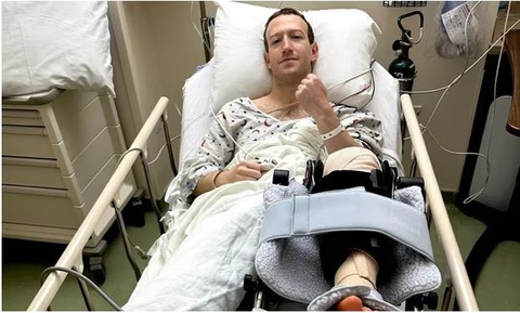 Tỷ phú Mark Zuckerberg phải lên bàn mổ vì luyện tập MMA quá sức - Ảnh 1. Mark Zuckerberg chia sẻ những bức ảnh từ bệnh viện sau khi trải qua ca phẫu thuật đầu gối - Ảnh: Instagram