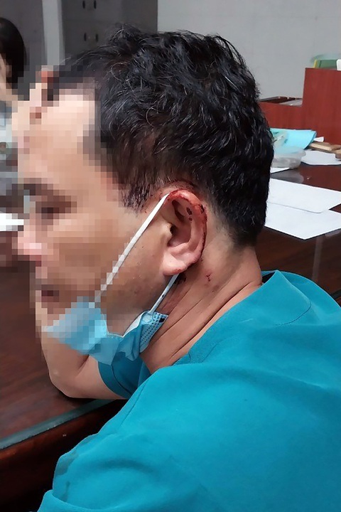 Điều dưỡng bị người nhà bệnh nhân hành hung ngay trong bệnh viện - Ảnh 1. Anh Trương Ngọc Nghĩa, điều dưỡng thuộc Bệnh viện Đa khoa tỉnh Bình Phước, với vết thương ở đầu do người nhà bệnh nhân hành hung - Ảnh: AN BÌNH