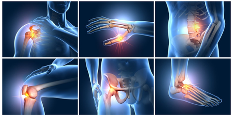 Các vị trí như khớp gối, háng, cổ tay, bàn tay, cổ chân… là những nơi khớp thường bị thoái hóa - Ảnh: Bệnh viện Hồng Ngọc Các vị trí như khớp gối, háng, cổ tay, bàn tay, cổ chân… là những nơi khớp thường bị thoái hóa - Ảnh: Bệnh viện Hồng Ngọc