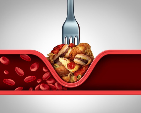 Cholesterol cao, 4 dấu hiệu cảnh báo mỡ tích tụ - Ảnh 1. Chế độ dinh dưỡng thiếu khoa học khiến người dân bị mỡ máu cao - Ảnh: Shutterstock