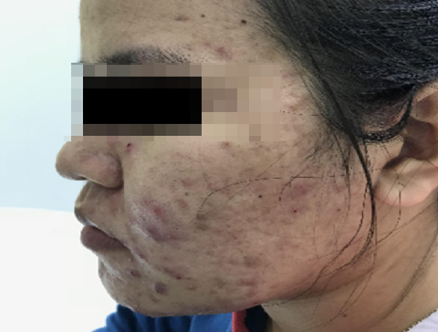 Ác mộng da xấu, mũi to khi mang bầu và sinh con, chăm sóc thế nào an toàn? - Ảnh 1. Ác mộng da xấu, mũi to khi mang bầu và sinh con, chăm sóc thế nào an toàn? - Ảnh 1.