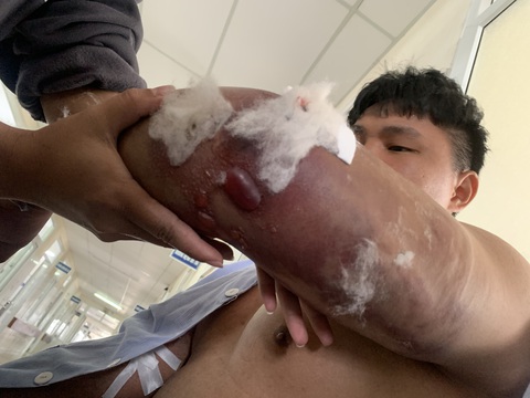 Bắt giữ khẩn cấp người đàn ông đánh shipper gãy hai tay - Ảnh 4. Bắt giữ khẩn cấp người đàn ông đánh shipper gãy hai tay - Ảnh 4.