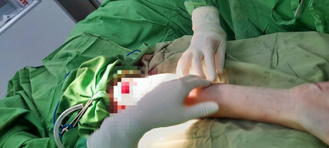 Đã chuyển hồ sơ xem xét yếu tố hình sự vụ chó cắn du khách - Ảnh 1. Đã chuyển hồ sơ xem xét yếu tố hình sự vụ chó cắn du khách - Ảnh 1.