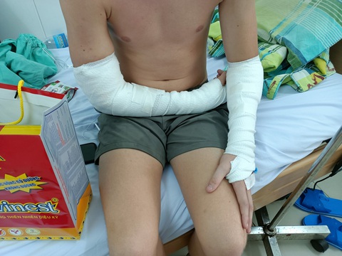 Tiêu hủy con chó cắn du khách ở Nha Trang - Ảnh 1. Tiêu hủy con chó cắn du khách ở Nha Trang - Ảnh 1.