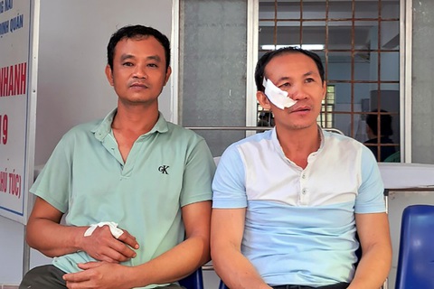 Ba kiểm lâm Vườn quốc gia Cát Tiên bị nhóm săn trộm chém trọng thương - Ảnh 2. Ba kiểm lâm Vườn quốc gia Cát Tiên bị nhóm săn trộm chém trọng thương - Ảnh 2.