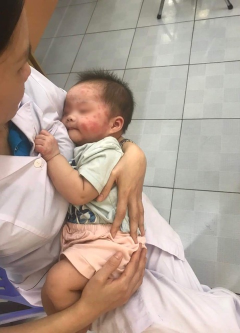 Bé gái 7 tháng tuổi bị bỏ bên đường, muỗi đốt sưng đỏ người - Ảnh 1. Bé gái khoảng 7 tháng tuổi được phát hiện bên vệ đường xã Hồng Thái Tây, thị xã Đông Triều, tỉnh Quảng Ninh trong tình trạng muỗi đốt sưng đỏ vùng mặt - Ảnh: Facebook Quảng Ninh 24/7