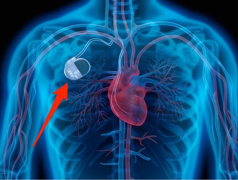 Bão Mặt trời gây những sự kiện kỳ lạ trên Trái đất - Ảnh 6. Bão Mặt trời gây những sự kiện kỳ lạ trên Trái đất - Ảnh 6.