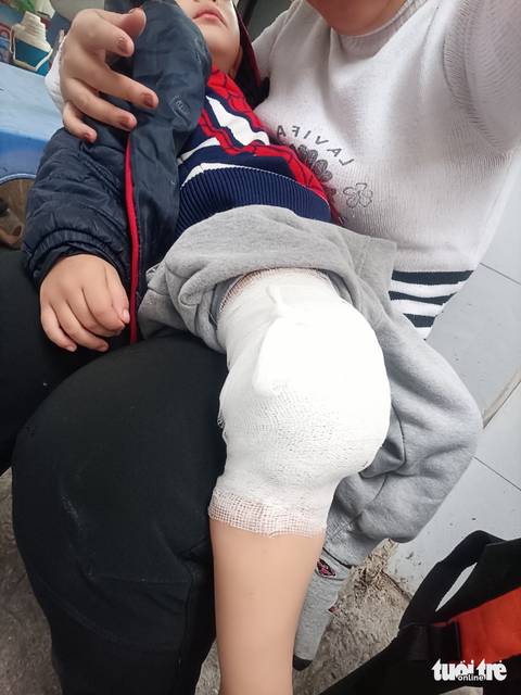 Bé 3 tuổi gãy chân trong lớp ở Hà Nội: Cơ sở mầm non phải đóng cửa từ 14-4 - Ảnh 2. Bé 3 tuổi gãy chân trong lớp ở Hà Nội: Cơ sở mầm non phải đóng cửa từ 14-4 - Ảnh 2.