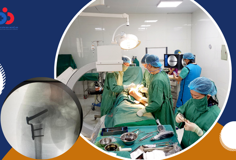 Trẻ bỗng dưng đi cà nhắc, cha mẹ chớ chủ quan - Ảnh 1. Trẻ bỗng dưng đi cà nhắc, cha mẹ chớ chủ quan - Ảnh 1.