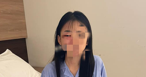 Nữ sinh lớp 8 ở Hà Nội bị đánh hội đồng phải nhập viện - Ảnh 1. Nữ sinh lớp 8 ở Hà Nội bị đánh hội đồng phải nhập viện - Ảnh 1.