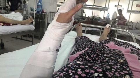 Công an vào cuộc vụ chồng đánh vợ dã man - Ảnh 1. Công an vào cuộc vụ chồng đánh vợ dã man - Ảnh 1.