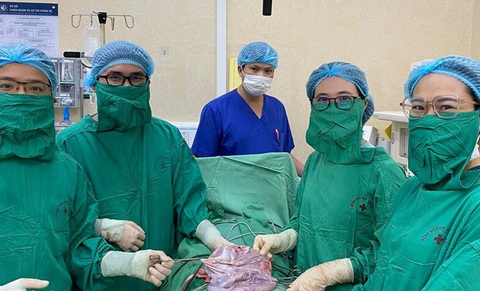 3 tháng u nhầy buồng trứng nặng 8 kg - Ảnh 1. Phẫu thuật u nang nhầy buồng trứng cho bệnh nhân - Ảnh: BVCC