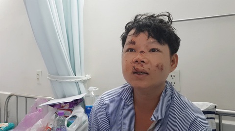 Phụ lái xe tải lật ở Phú Yên kể thời khắc kinh hoàng xe mất thắng - Ảnh 1. Phụ lái xe tải lật ở Phú Yên kể thời khắc kinh hoàng xe mất thắng - Ảnh 1.