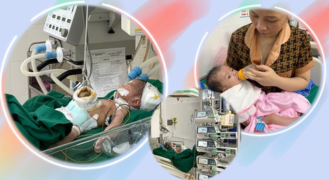 3 lần phẫu thuật đưa nội tạng, ruột, gan của trẻ sơ sinh vào ổ bụng - Ảnh 1. Trẻ bị thoát vị cuống rốn phức tạp đã được cứu sống sau 3 lần phẫu thuật - Ảnh: BVCC