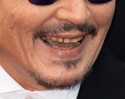 Fan ngán ngẩm với hàm răng mục nát của Johnny Depp - Ảnh 5. Fan ngán ngẩm với hàm răng mục nát của Johnny Depp - Ảnh 5.