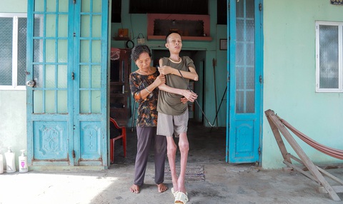 Mọi sinh hoạt của anh Tú đều cần bàn tay yêu thương của người mẹ già 63 tuổi - Ảnh: AN VI Mọi sinh hoạt của anh Tú đều cần bàn tay yêu thương của người mẹ già 63 tuổi - Ảnh: AN VI