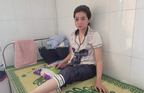 Bị chồng cũ đánh rạn xương hàm khi đến đón con - Ảnh 1. Bị chồng cũ đánh rạn xương hàm khi đến đón con - Ảnh 1.