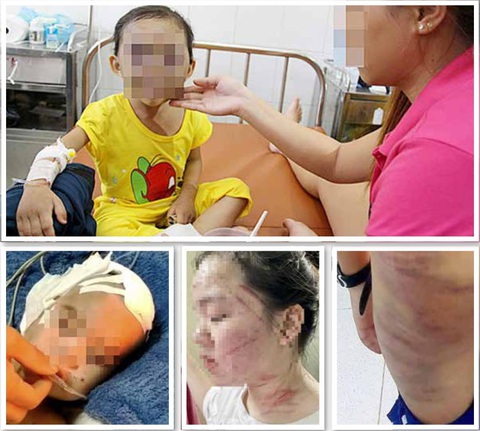 Trẻ em bị bạo hành - Ảnh: T.L. Trẻ em bị bạo hành - Ảnh: T.L.