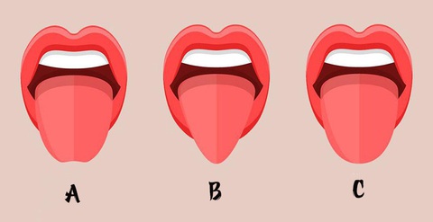 Hình dáng lưỡi bật mí tính cách thú vị của bạn - Ảnh 1. Hình dáng lưỡi bật mí tính cách thú vị của bạn - Ảnh 1.