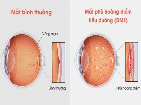 Tin tức sáng 18-6: Hôm nay, khởi công đường vành đai 3 TP.HCM - Ảnh 6. Tin tức sáng 18-6: Hôm nay, khởi công đường vành đai 3 TP.HCM - Ảnh 6.