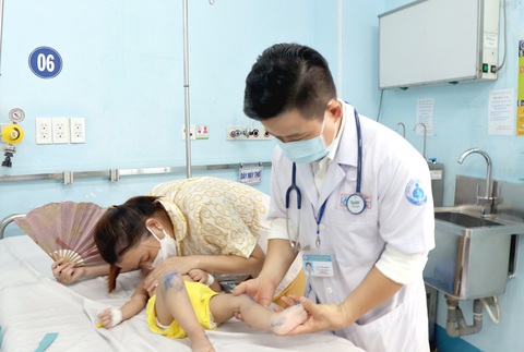 Một trường hợp trẻ mắc tay chân miệng được bác sĩ chăm sóc - Ảnh: Xuân Mai Một trường hợp trẻ mắc tay chân miệng được bác sĩ chăm sóc - Ảnh: Xuân Mai