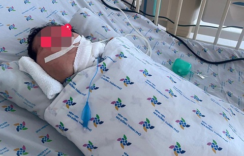 Đặt nội khí quản ngay lúc ra đời, trẻ có khối bướu khổng lồ đã tự thở - Ảnh 2. Đặt nội khí quản ngay lúc ra đời, trẻ có khối bướu khổng lồ đã tự thở - Ảnh 2.