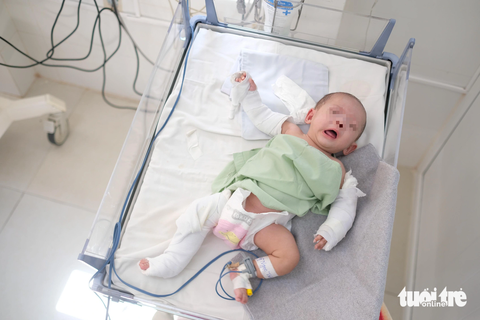 Vụ bé gái 3 tháng tuổi bị người tình của mẹ hành hạ: Trung tâm bảo trợ xã hội nhận nuôi dưỡng - Ảnh 1. Bé Nguyễn Ngọc Trân Châu bị người tình của mẹ hành hạ đến gãy chân tay, chấn thương não - Ảnh: M.V.