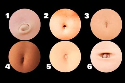 Hình dạng lỗ rốn tiết lộ tính cách của bạn - Ảnh 1. Hình dạng lỗ rốn tiết lộ tính cách của bạn - Ảnh 1.