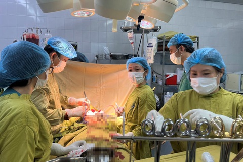 Hồi sinh bệnh nhân ngưng tim: 'Mở ngực, quả tim đã ngừng đập, tím ngắt' - Ảnh 1. Ê kíp bác sĩ Bệnh viện Thống Nhất (TP.HCM) thức trắng đêm cứu sống ngoạn mục nam bệnh nhân ngưng tim - Ảnh: Bác sĩ cung cấp