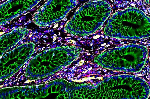 Trường Y khoa Stanford chụp được hình ảnh siêu chi tiết ruột con người - Ảnh 3. Cận cảnh protein, vi khuẩn, tế bào miễn dịch - Ảnh: STANFORD MEDICINE