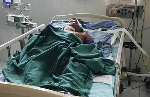 Lấy tổ ong vò vẽ bán nhộng kiếm tiền, người đàn ông bị ong vò vẽ đốt nguy kịch - Ảnh 1. Anh P. đang được hồi sức cấp cứu trong tình trạng nguy kịch do bị ong vò vẽ đốt - Ảnh: Người dân cung cấp