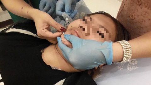 Tăng cường quản lý cơ sở thẩm mỹ là hoạt động trọng tâm ngành y tế cuối năm 2023 - Ảnh 1. Một khách hàng tiêm độn cằm tại cơ sở thẩm mỹ chui trên đường Tôn Thất Thuyết, quận 4 - Ảnh: T.H.