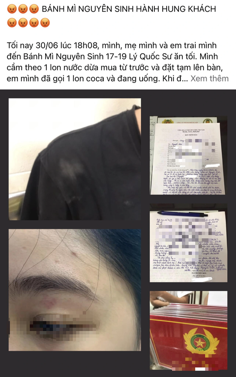 Chuyển hồ sơ vụ nhân viên quán bánh mì Nguyên Sinh hành hung khách lên công an quận xử lý - Ảnh 1. Bài viết tố cáo nhân viên quán bánh mì Nguyên Sinh hành hung khách được đăng trên Facebook - Ảnh chụp màn hình