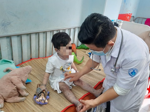 Trẻ mắc tay chân miệng được điều trị tại Bệnh viện Nhi đồng 1 (TP.HCM) - Ảnh: THU HIẾN Trẻ mắc tay chân miệng được điều trị tại Bệnh viện Nhi đồng 1 (TP.HCM) - Ảnh: THU HIẾN