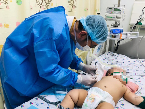 TP.HCM: Nhiều ca mắc sốt xuất huyết nặng, cứu trẻ bị cô đặc máu - Ảnh 3. Bé V.M.Q. (5 tháng tuổi, ngụ tỉnh Bình Thuận) bị sốc sốt xuất huyết nặng, trên cơ địa dư cân - Ảnh: Bác sĩ cung cấp