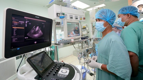 Bệnh nhân được ghép tim ở Huế hồi phục đáng kinh ngạc - Ảnh 2. Các chỉ số sinh tồn của anh G. được theo dõi sát sao trong quá trình ghép tim - Ảnh: THƯỢNG HIỂN
