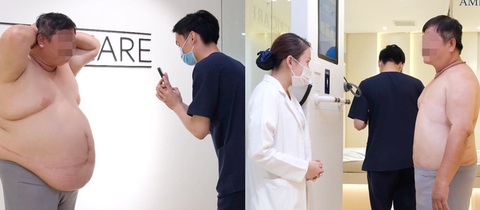 Nhân vật chú Đại trong clip “giảm 19kg sau một liệu trình giảm béo tại Americare clinic”- Ảnh cắt từ clip quảng cáo của Americare clinic Nhân vật chú Đại trong clip “giảm 19kg sau một liệu trình giảm béo tại Americare clinic”- Ảnh cắt từ clip quảng cáo của Americare clinic