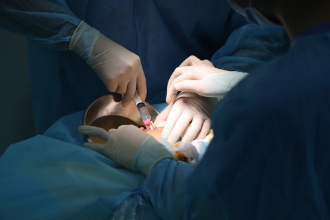 Tiêm filler làm đẹp: Phổ biến nhưng ít ai biết chỉ được tiêm ở mặt, cổ và tay - Ảnh 1. Một ca tai biến khi tiêm filler vùng ngực được các bác sĩ Bệnh viện Da liễu (TP.HCM) bơm, rửa, nạo để lấy chất làm đầy và mủ - Ảnh: BVCC