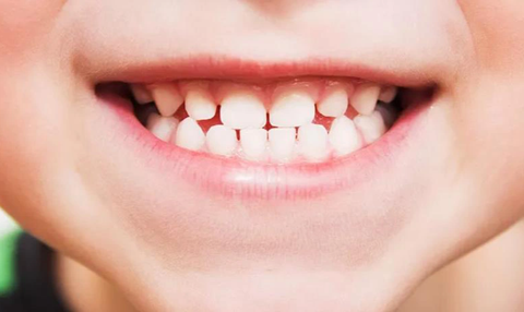 Phát triển loại thuốc mới giúp răng mọc lại - Ảnh 1. Răng sữa trẻ em - Ảnh: EURO NEWS