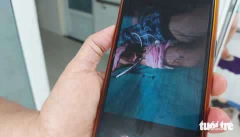 Vụ đánh ngư dân trên tàu cá: Bộ đội Biên phòng Kiên Giang giải cứu thêm hai ngư dân khác - Ảnh 2. Ông T. - một trong những ngư dân bị bạn đi chung tàu đánh cá đánh gãy tay - Ảnh: CHÍ CÔNG