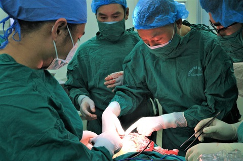 Đau răng, răng lung lay... người trẻ cẩn thận u men răng tàn phá khuôn mặt - Ảnh 2. Các bác sĩ Bệnh viện Hữu nghị Việt Tiệp phẫu thuật khối u men khổng lồ - Ảnh: BVCC