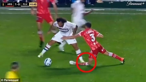 Marcelo bật khóc sau khi khiến đối thủ gãy chân kinh hoàng - Ảnh 2. Hình ảnh pha gãy chân kinh hoàng - Ảnh: Paramount