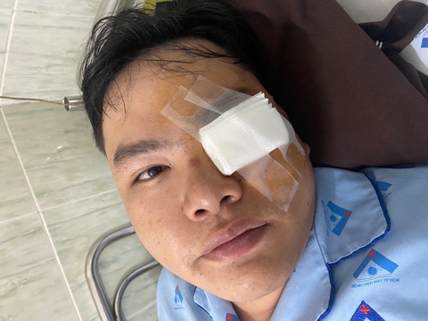 Nam thanh niên mổ mắt cấp cứu vì “va” vào gậy Cảnh sát giao thông? - Ảnh 1. Nam thanh niên tố bị cảnh sát giao thông "tác động" lúc nhập viện cấp cứu - Ảnh: NNCC