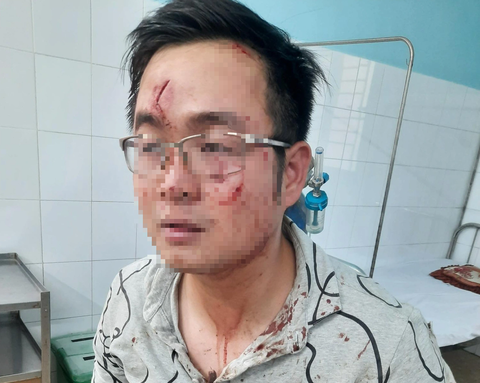 Hai người chặn xe trên cao tốc đánh người lên công an trình diện - Ảnh 3. Anh T. bị nhóm người dùng cây sắt đánh rách mặt - Ảnh: NVCC
